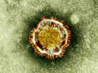 Here's the coronavirus that appears to have originated in the Middle East and has caused severe illnesses in people living there and in Europe.