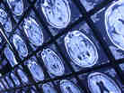 Your brain will appreciate even a modest improvement in stroke risk factors.