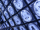 Your brain will appreciate even a modest improvement in stroke risk factors. Your brain will appreciate even a modest improvement in stroke risk factors.