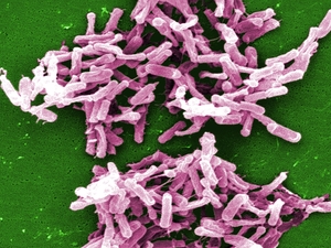 Bad bug: The bacterium Clostridium difficile kills 14,000 people in the United States each year.