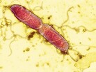 It's busy down there: a gut bacterium splits into two, becoming two new cells. It's busy down there: a gut bacterium splits into two, becoming two new cells.