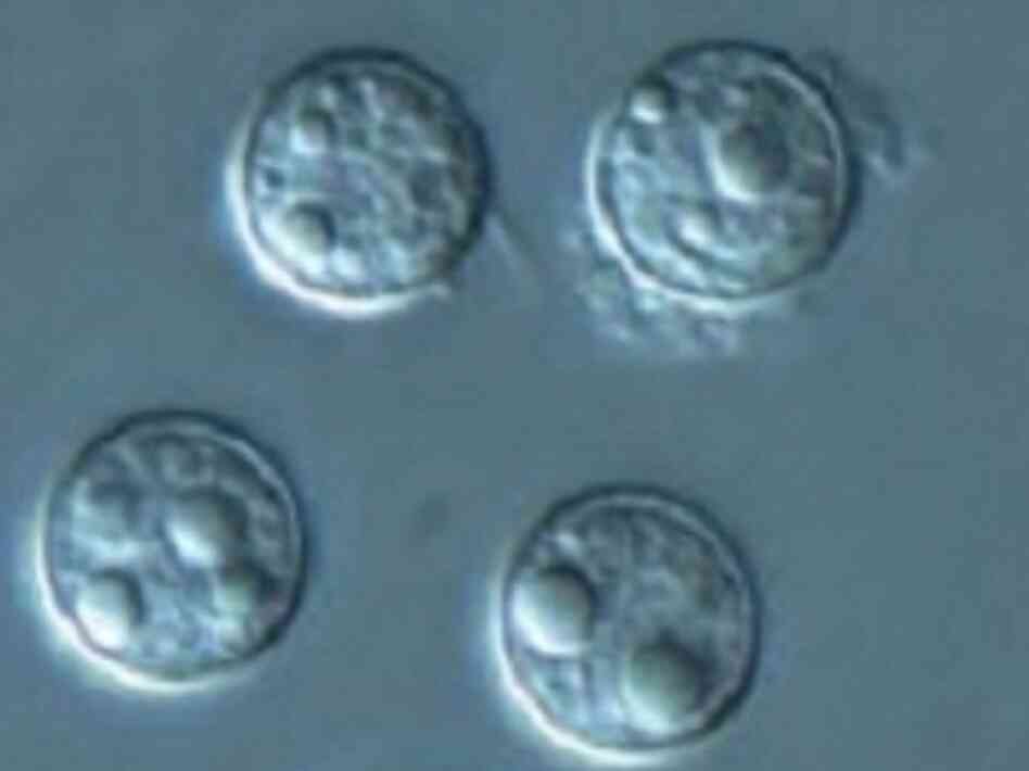 Cyclospora is a tough parasite that can survive for weeks outside the human body. Cyclospora is a tough parasite that can survive for weeks outside the human body.