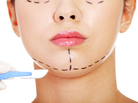Plastic surgeons tend to say a patient is going to look "refreshed," not younger. Plastic surgeons tend to say a patient is going to look "refreshed," not younger.