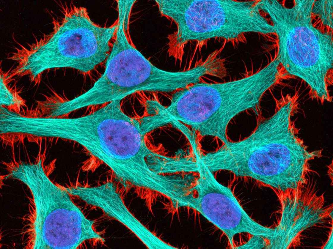 HeLa cells have been mentioned in more than 70,000 published scientific papers.