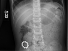 There's only one way to know if magnets and kids attract: with an x-ray. There's only one way to know if magnets and kids attract: with an x-ray.