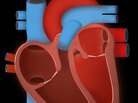 Heart Heart