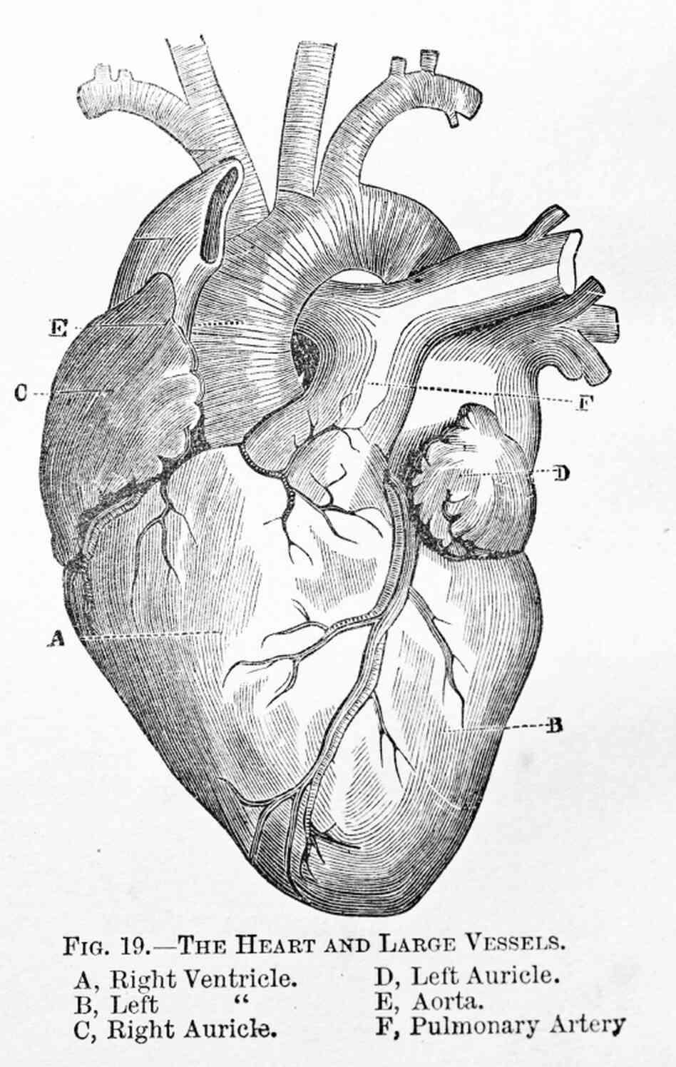 There's been great progress in treating heart disease, but it remains the top killer in the U.S. There's been great progress in treating heart disease, but it remains the top killer in the U.S.