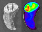 The image on the left is a piece of lung tissue that contains a tumor viewed under normal white light. The right image shows the same piece of tissue after Tumor Paint has been applied. Here it's viewed under infrared light. Areas that are more red and yellow show a concentration of the paint, which means they are more likely to be cancerous. The image on the left is a piece of lung tissue that contains a tumor viewed under normal white light. The right image shows the same piece of tissue after Tumor Paint has been applied. Here it's viewed under infrared light. Areas that are more red and yellow show a concentration of the paint, which means they are more likely to be cancerous.