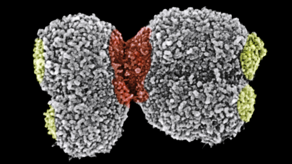 The greenish-yellow tips on this human chromosome (No. 16) are telomeres.
