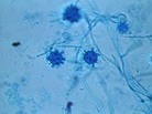 Histoplasma capsulatum is common in soil in the Midwest and Mid-Atlantic. So how did it get a rancher in Montana sick? Histoplasma capsulatum is common in soil in the Midwest and Mid-Atlantic. So how did it get a rancher in Montana sick?