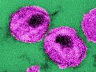 These HIV viruses even look a little like bull's-eyes. These HIV viruses even look a little like bull's-eyes.