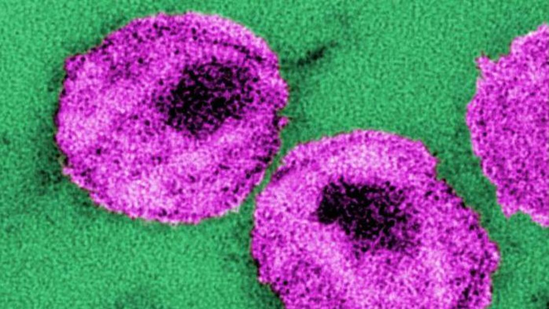 These HIV viruses even look a little like bull's-eyes.
