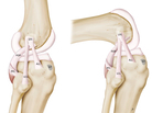 An anatomical drawing shows the ligaments on the outside surface of the knee. The anterolateral ligament connects the thigh bone to the shinbone. An anatomical drawing shows the ligaments on the outside surface of the knee. The anterolateral ligament connects the thigh bone to the shinbone.