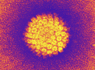 The human papilloma virus causes most cervical cancers. That's why HPV testing is now recommended for women ages 30 to 65. The human papilloma virus causes most cervical cancers. That's why HPV testing is now recommended for women ages 30 to 65.
