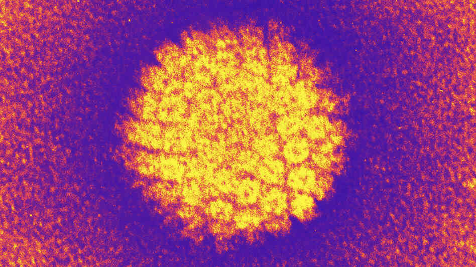 The human papilloma virus causes most cervical cancers. That's why HPV testing is now recommended for women ages 30 to 65. The human papilloma virus causes most cervical cancers. That's why HPV testing is now recommended for women ages 30 to 65.