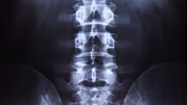 The price for an X-ray is murkier than the image. (iStockphoto.com)