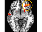 When researchers at Weill Cornell Medical College scanned teenage brains, they found that the area that regulates emotional responses has to work harder to keep impulses in check. When researchers at Weill Cornell Medical College scanned teenage brains, they found that the area that regulates emotional responses has to work harder to keep impulses in check.