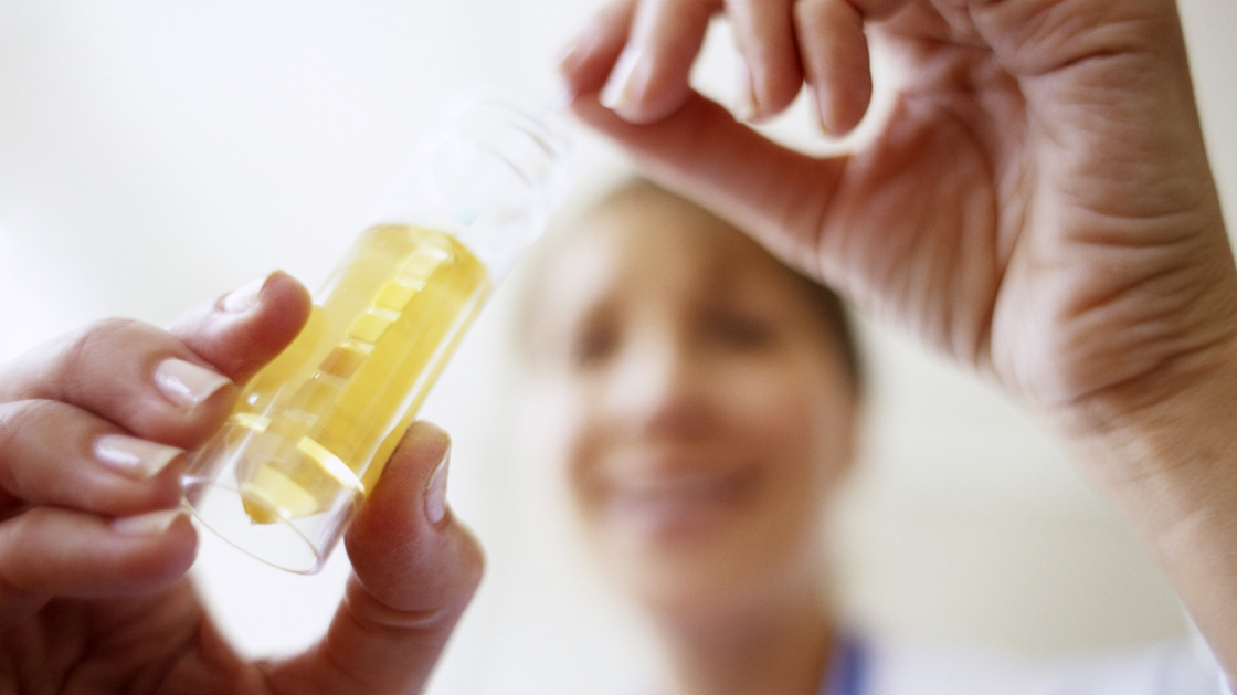 Urine tests are the gold standard for diagnosing bladder infections. But one common test, the urine culture, can easily miss infections. Urine tests are the gold standard for diagnosing bladder infections. But one common test, the urine culture, can easily miss infections.
