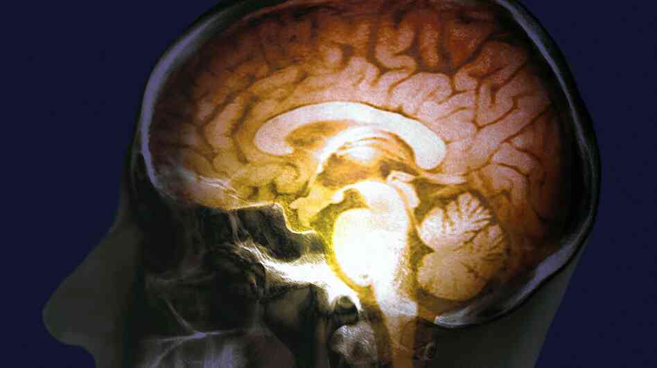 President Obama has pledged millions of dollars to fuel research into understanding the workings of the human brain. President Obama has pledged millions of dollars to fuel research into understanding the workings of the human brain.