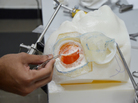A simulated patient at the University of Malaya makes use of different materials to mimic the look and feel of human tissue. A simulated patient at the University of Malaya makes use of different materials to mimic the look and feel of human tissue.