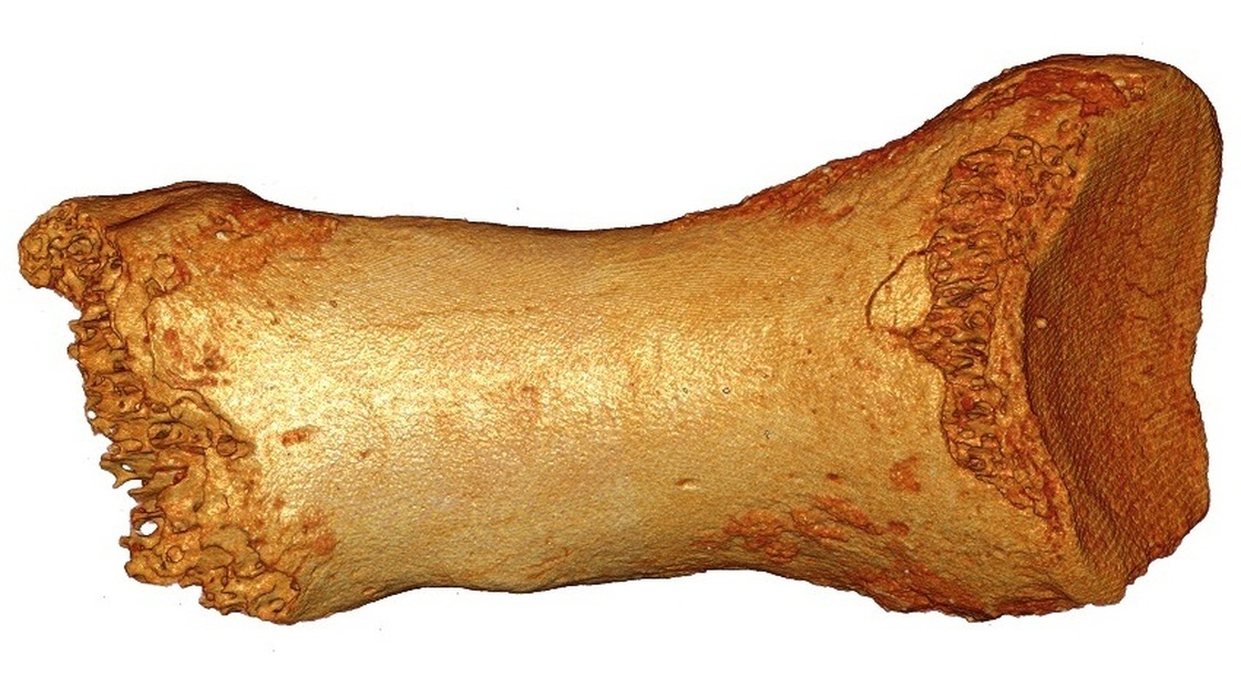 DNA from this ancient toe bone, discovered in a cave in Siberia, was traced to Neanderthals and and at least one other newly identified group of early hominids — the Denisovans. DNA from this ancient toe bone, discovered in a cave in Siberia, was traced to Neanderthals and and at least one other newly identified group of early hominids — the Denisovans.