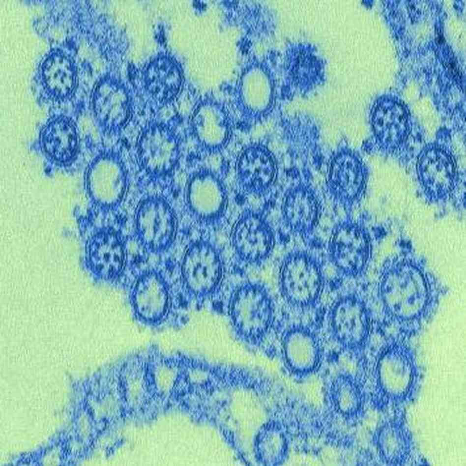 The 2009 H1N1 flu virus viewed under the microscope. The 2009 H1N1 flu virus viewed under the microscope.
