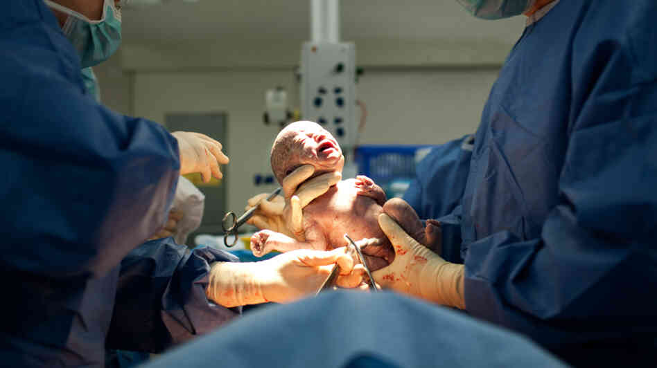 A C-section delivery may be needed to protect the health of mother and child. But too many are done for the wrong reasons, doctors say. A C-section delivery may be needed to protect the health of mother and child. But too many are done for the wrong reasons, doctors say.