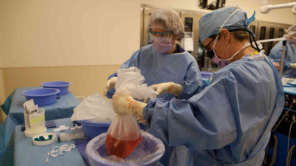 Doyle (right) ices down a liver to prepare it for transplant. Doyle (right) ices down a liver to prepare it for transplant.