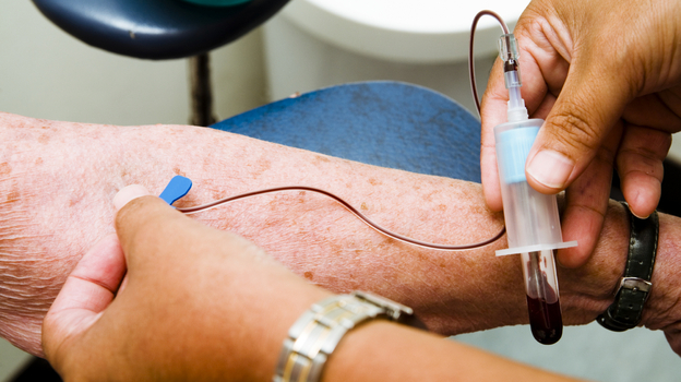 Scientists have long sought a way to detect Alzheimer's before symptoms appear. (iStockphoto)