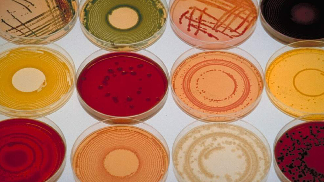In some human diseases, the wrong mix of bacteria seems to be the trouble.