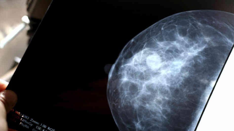 A mammogram. A mammogram.