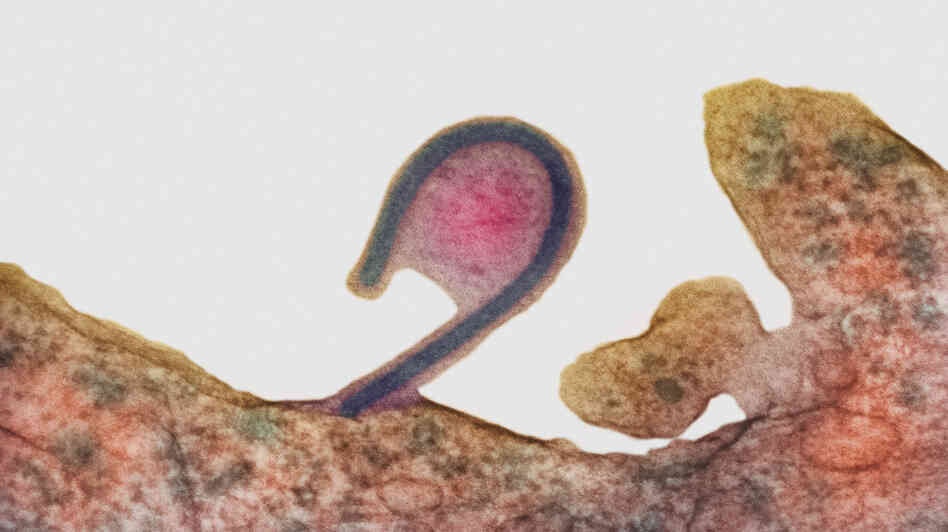 In this colored transmission electron micrograph, an infected cell (reddish brown) releases a single Ebola virus (the blue hook). As it exits, the virus takes along part of the host cell's membrane (pink, center), too. That deters the host's immune defenses from recognizing the virus as foreign. In this colored transmission electron micrograph, an infected cell (reddish brown) releases a single Ebola virus (the blue hook). As it exits, the virus takes along part of the host cell's membrane (pink, center), too. That deters the host's immune defenses from recognizing the virus as foreign.