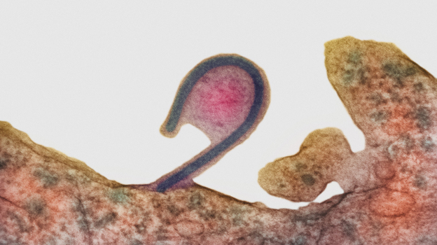 In this colored transmission electron micrograph, an infected cell (reddish brown) releases a single Ebola virus (the blue hook). As it exits, the virus takes along part of the host cell's membrane (pink, center), too. That deters the host's immune defenses from recognizing the virus as foreign. (Science Source)