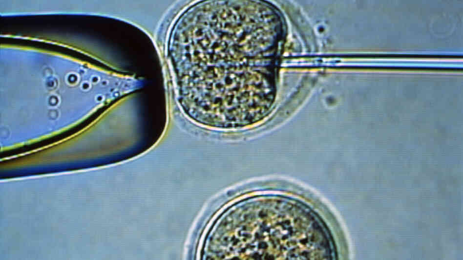 This mouse egg (top) is being injected with genetic material from an adult cell to ultimately create an embryo — and, eventually, embryonic stem cells. The process has been difficult to do with human cells. This mouse egg (top) is being injected with genetic material from an adult cell to ultimately create an embryo — and, eventually, embryonic stem cells. The process has been difficult to do with human cells.