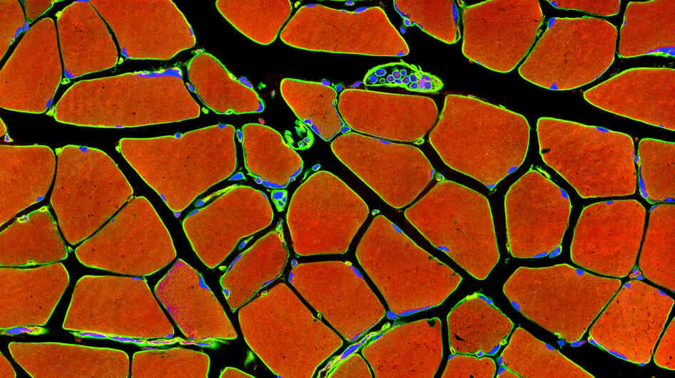 A cross-section of skeletal muscle in this light micrograph shows the individual, parallel muscle fibers (red). These fibers work in concert to power movement. A cross-section of skeletal muscle in this light micrograph shows the individual, parallel muscle fibers (red). These fibers work in concert to power movement.