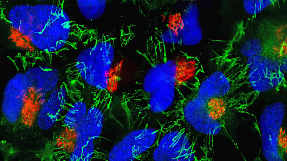 Human cervical cancer cells in a fluorescence micrograph. Human cervical cancer cells in a fluorescence micrograph.