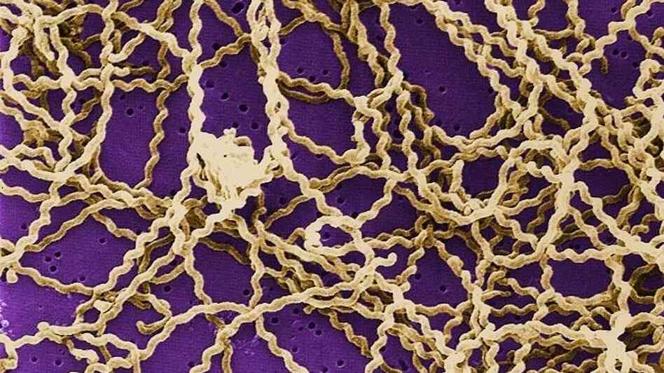 Doctors used a rapid DNA test to identify a Wisconsin teen's unusual infection with Leptospira bacteria (yellow), which are common in the tropics. Doctors used a rapid DNA test to identify a Wisconsin teen's unusual infection with Leptospira bacteria (yellow), which are common in the tropics.