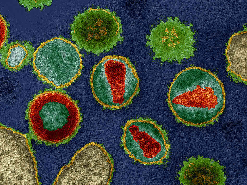Human immunodeficiency virus Type 1 inserts its genetic material into the DNA of human cells, turning them into little HIV factories. Human immunodeficiency virus Type 1 inserts its genetic material into the DNA of human cells, turning them into little HIV factories.