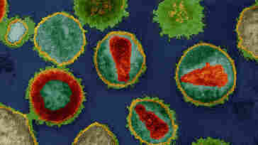 Child Thought Cured Of HIV Shows Signs Of Infection Child Thought Cured Of HIV Shows Signs Of Infection