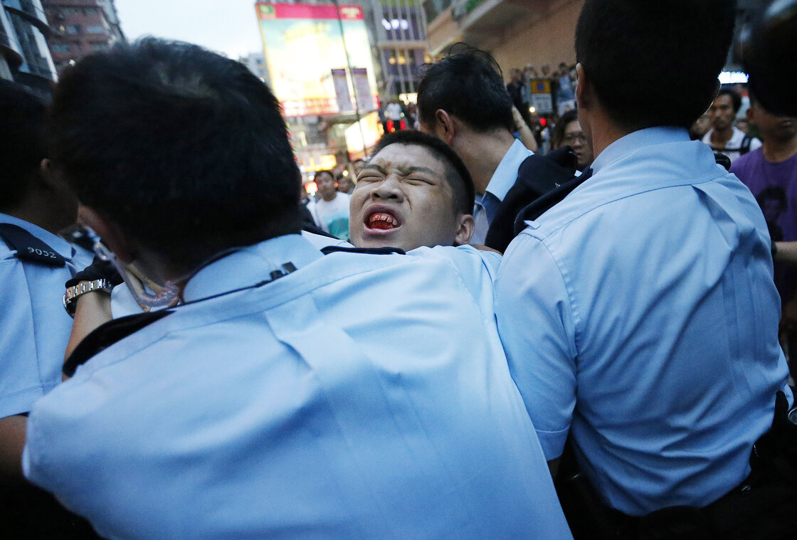 A student protester is injured after being pulled off and hit by residents and pro-Beijing supporters. A student protester is injured after being pulled off and hit by residents and pro-Beijing supporters.