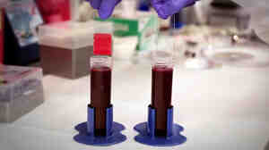 The slide on the right has been treated with a coating that repels blood.