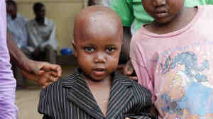 After beating Ebola, young Ibrahim celebrated by proposing to his nurse.