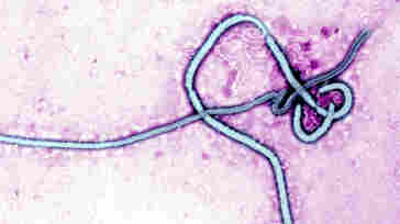 Ebola Virus, Transmission Electron Micrograph Of The Ebola Virus, Rna Virus, Cause Of Hemorrhagic Fever.