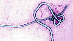 Ebola Virus, Transmission Electron Micrograph Of The Ebola Virus, Rna Virus, Cause Of Hemorrhagic Fever.