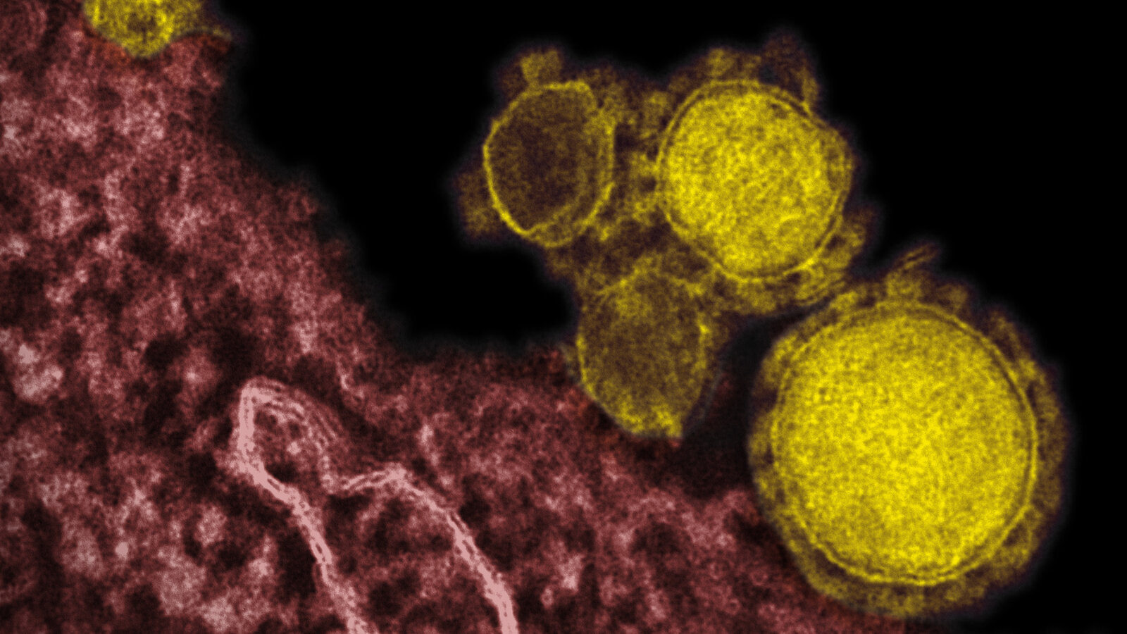 A transmission electron micrograph shows Middle East respiratory syndrome coronavirus particles (colorized yellow).