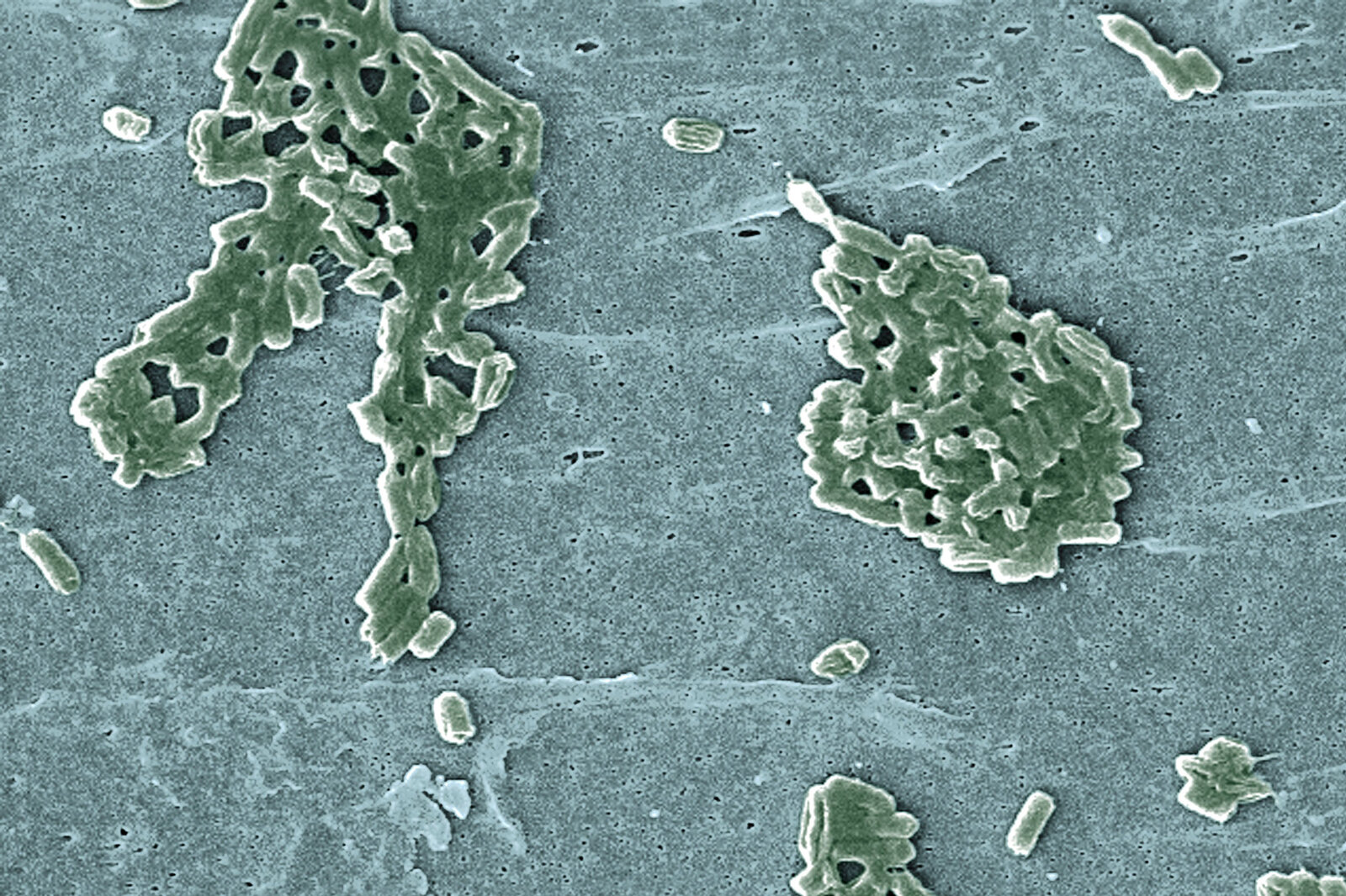 Scientists reprogrammed the common bacterium E. coli so it requires a synthetic amino acid to live. Scientists reprogrammed the common bacterium E. coli so it requires a synthetic amino acid to live.
