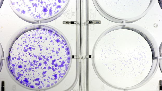 It's a good start when experimental compounds stop the proliferation of cancer cells in the lab. But, as many researchers have learned the hard way, that's just an early step toward creating a worthwhile treatment. (Science Source)