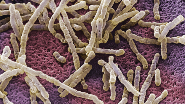 An overgrowth of Clostridium difficile bacteria can inflame the colon with a life-threatening infection. (Getty Images/Visuals Unlimited)