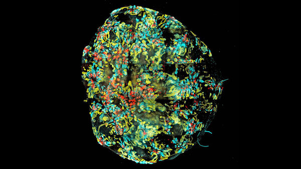 Image of a mini-kidney formed in a dish from human induced pluripotent stem cells. (Minoru Takasato/Nature) Image of a mini-kidney formed in a dish from human induced pluripotent stem cells.