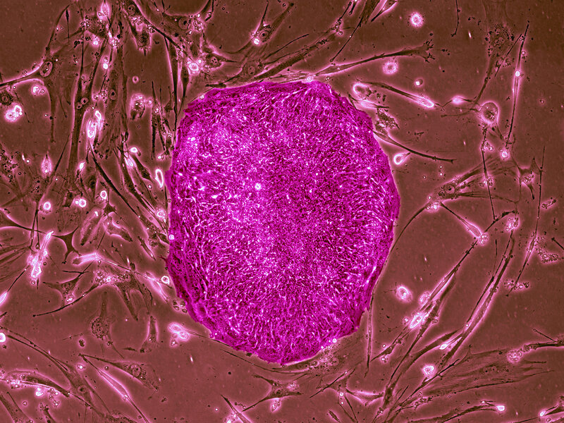 Human stem cells, in this case made from adult skin cells, can give rise to any sort of human cell. Some scientists would like to insert such cells into nonhuman, animal embryos, in hopes of one day growing human organs for transplantation. (Science Source) Human stem cells, in this case made from adult skin cells, can give rise to any sort of human cell. Some scientists would like to insert such cells into nonhuman, animal embryos, in hopes of one day growing human organs for transplantation. (Science Source)